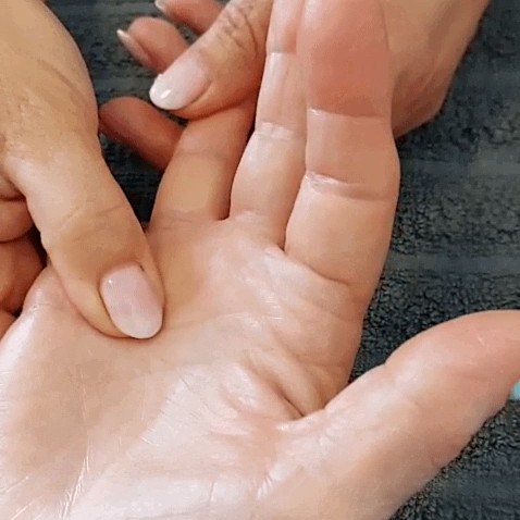 שרון בודקת את בסיס האצבע בכף היד של מטופלת